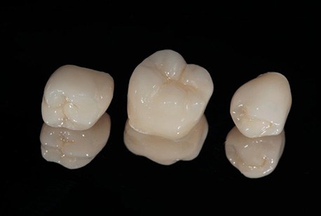Dental crowns