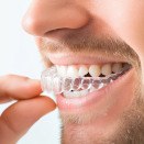 Close-up of man’s mouth as he places clear aligner on teeth