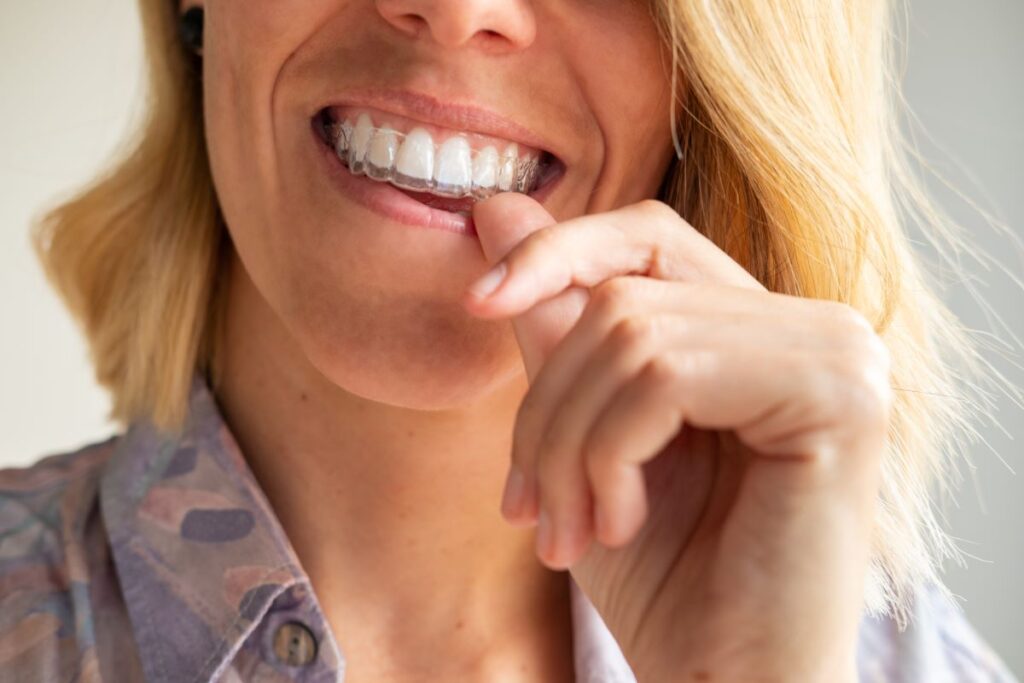 A woman putting on a Smart Moves clear aligner.